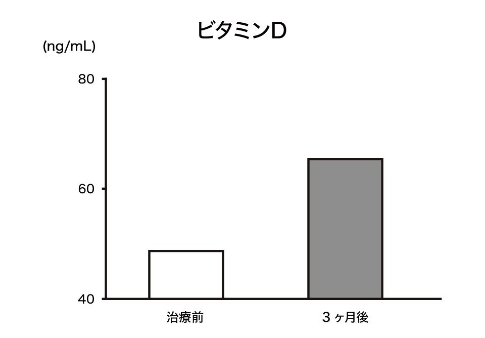 ビタミンD